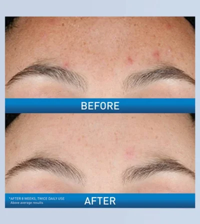 CeraVe Resurfacing Retinol Serum - Image 4